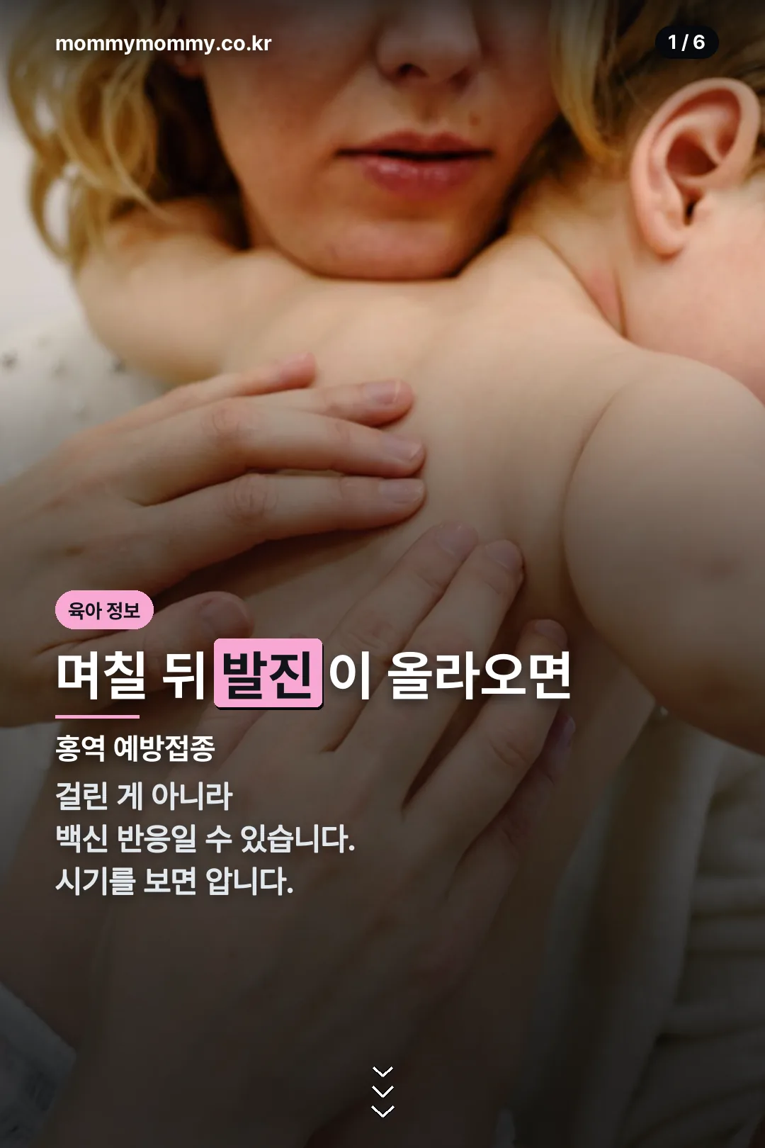 홍역 예방접종 후 발진 표지