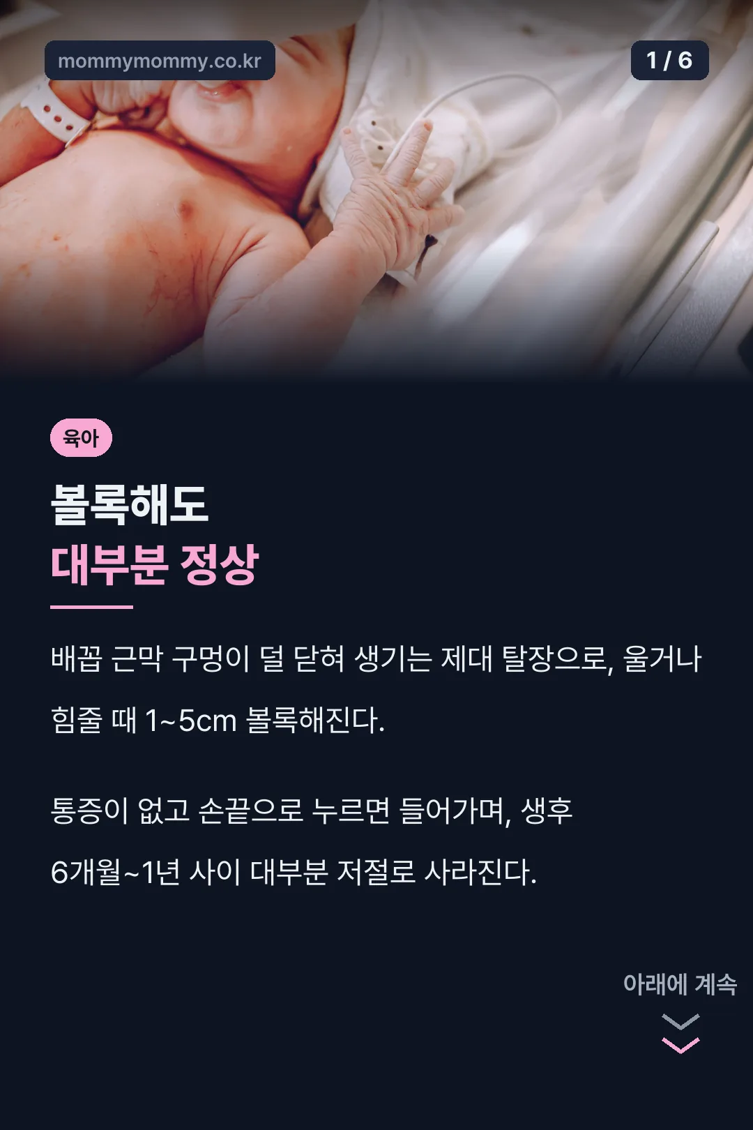 신생아 배꼽 튀어나옴