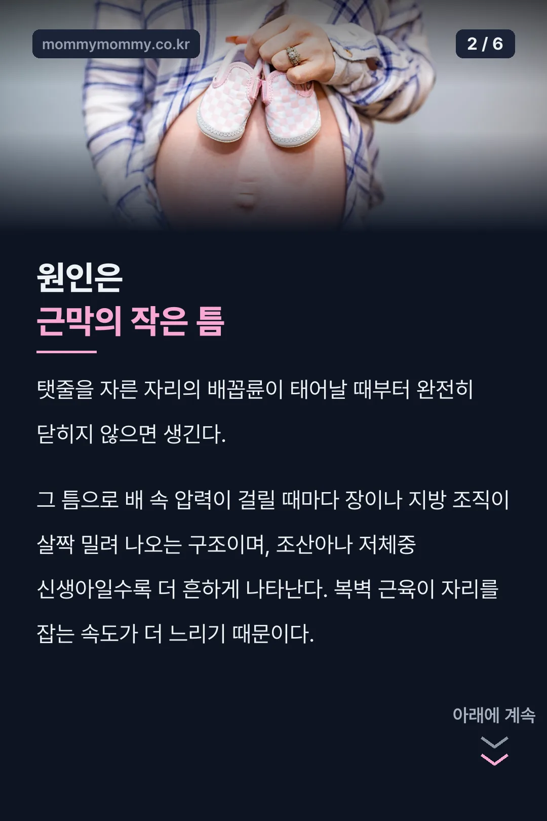제대 탈장 원인