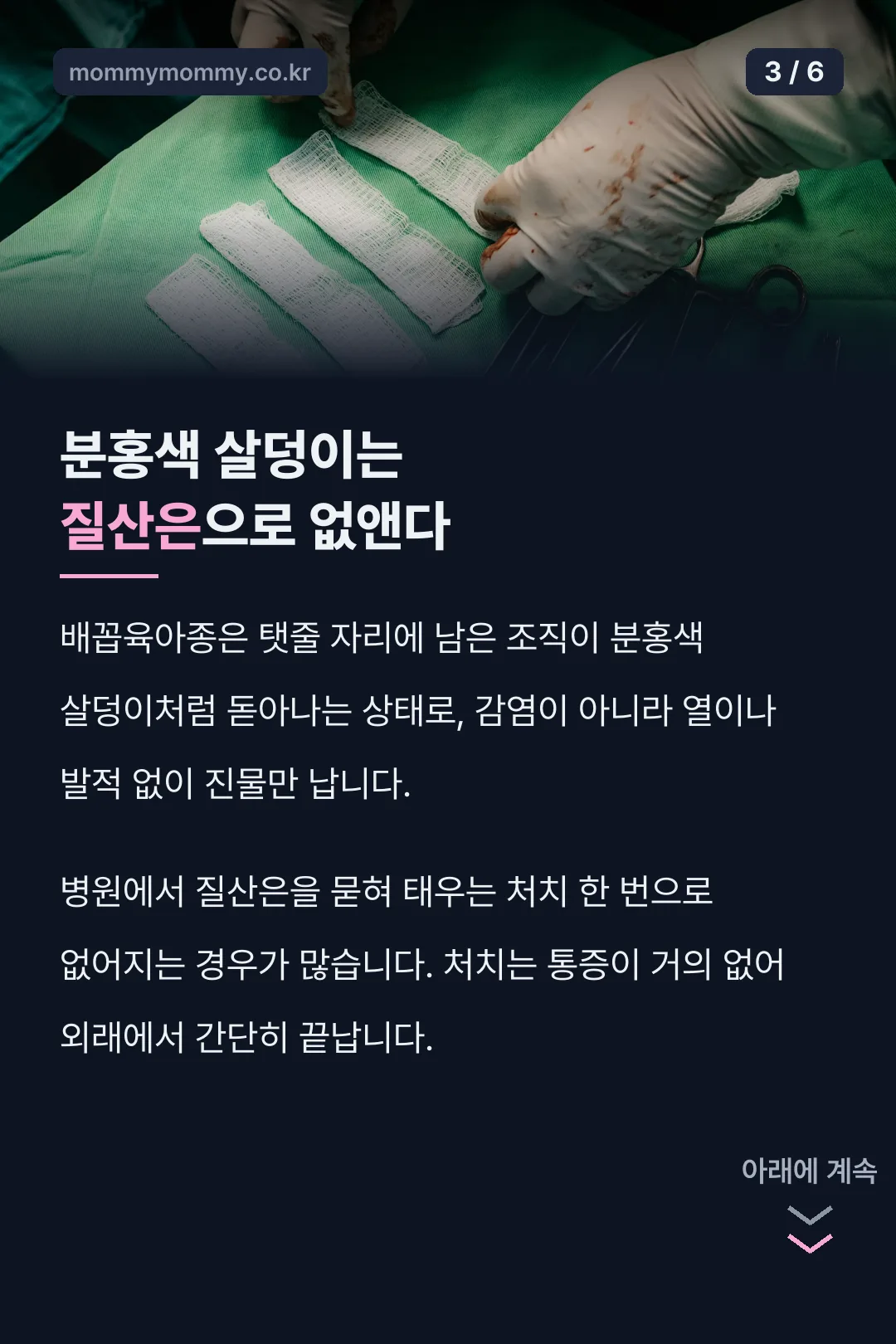 배꼽육아종 처치법