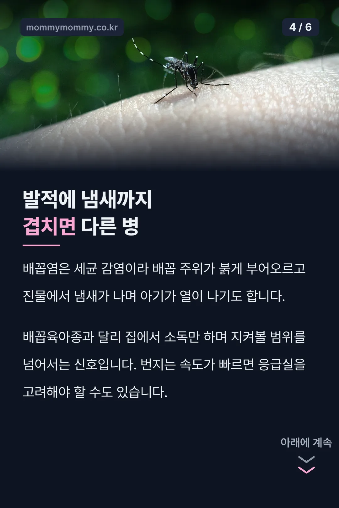배꼽염 구분 신호